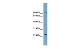 Anti-C15ORF15 antibody, Internal used in Western Blot (WB). GTX45009
