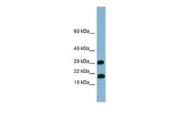 Anti-TRAPPC2L antibody, N-term used in Western Blot (WB). GTX45017