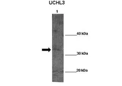 Anti-UCHL5 antibody, Internal used in Western Blot (WB). GTX45025