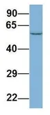 Anti-LAP3 antibody, N-term used in Western Blot (WB). GTX45029