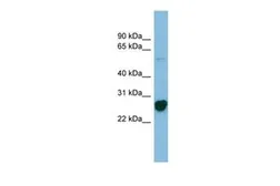 Anti-RPL10A antibody, N-term used in Western Blot (WB). GTX45038