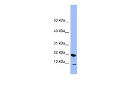 Anti-PIN4 antibody, N-term used in Western Blot (WB). GTX45042
