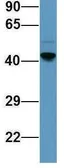 Anti-SERPINE2 antibody, Internal used in Western Blot (WB). GTX45043