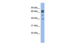 Anti-SH3GL2 antibody, Internal used in Western Blot (WB). GTX45052