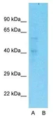 Anti-Pentraxin 3 antibody, N-term used in Western Blot (WB). GTX45054