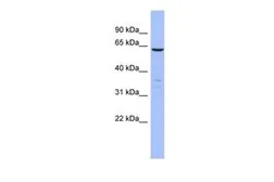 Anti-PLS1 antibody, N-term used in Western Blot (WB). GTX45058