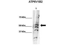 Anti-ATP6V1B2 antibody, N-term used in Western Blot (WB). GTX45066