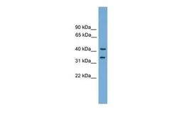 Anti-FAM118A antibody, Internal used in Western Blot (WB). GTX45068
