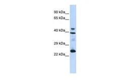 Anti-Selenoprotein P antibody, N-term used in Western Blot (WB). GTX45069