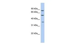 Anti-FAM63A antibody, Internal used in Western Blot (WB). GTX45077