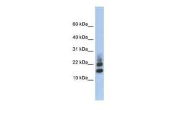 Anti-RPS15A antibody, Internal used in Western Blot (WB). GTX45086