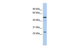 Anti-C1orf190 antibody, Internal used in Western Blot (WB). GTX45093