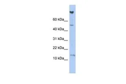 Anti-NRARP antibody, Internal used in Western Blot (WB). GTX45102