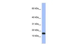 Anti-RPL37A antibody, Internal used in Western Blot (WB). GTX45107