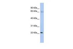 Anti-RPL18 antibody, N-term used in Western Blot (WB). GTX45108