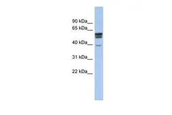 Anti-SPNS2 antibody, N-term used in Western Blot (WB). GTX45115
