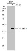 Anti-TGF beta 1 antibody used in Western Blot (WB). GTX45121