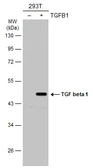 Anti-TGF beta 1 antibody used in Western Blot (WB). GTX45121