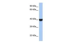 Anti-TMED8 antibody, Internal used in Western Blot (WB). GTX45130