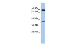 Anti-FAM190A antibody, N-term used in Western Blot (WB). GTX45133