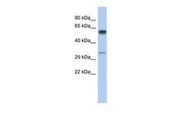 Anti-ZDHHC24 antibody, Internal used in Western Blot (WB). GTX45140