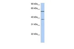 Anti-NUP43 antibody, Internal used in Western Blot (WB). GTX45155
