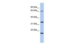Anti-FAM79B antibody, N-term used in Western Blot (WB). GTX45170