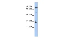 Anti-ANKRD47 antibody, N-term used in Western Blot (WB). GTX45174