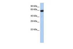 Anti-LRRTM1 antibody, Internal used in Western Blot (WB). GTX45195