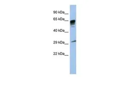 Anti-PRR18 antibody, Internal used in Western Blot (WB). GTX45207