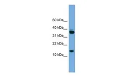Anti-PRR15 antibody, Internal used in Western Blot (WB). GTX45209