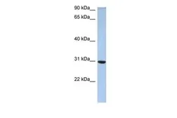 Anti-C16ORF65 antibody, Internal used in Western Blot (WB). GTX45219
