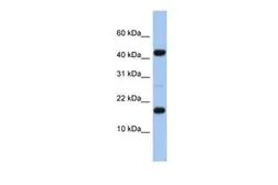 Anti-FLJ37543 antibody, N-term used in Western Blot (WB). GTX45225