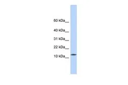 Anti-CDRT4 antibody, Internal used in Western Blot (WB). GTX45229