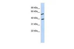 Anti-C6ORF146 antibody, Internal used in Western Blot (WB). GTX45235