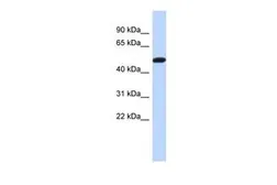 Anti-TRIML2 antibody, Internal used in Western Blot (WB). GTX45237