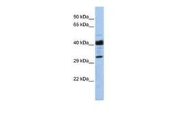 Anti-LRRC57 antibody, Internal used in Western Blot (WB). GTX45250