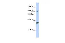 Anti-LRRC57 antibody, N-term used in Western Blot (WB). GTX45251