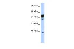 Anti-PXT1 antibody, Internal used in Western Blot (WB). GTX45253