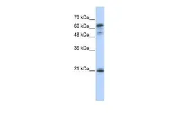 Anti-GCET2 antibody, Internal used in Western Blot (WB). GTX45254