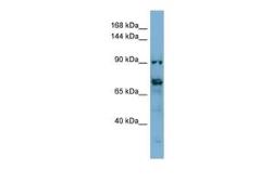 Anti-TMEM146 antibody, Internal used in Western Blot (WB). GTX45255