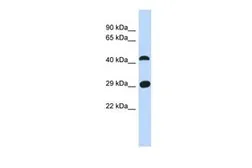 Anti-C4ORF22 antibody, N-term used in Western Blot (WB). GTX45258