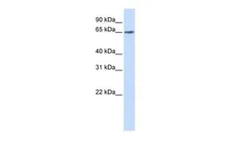 Anti-YTHDF3 antibody, N-term used in Western Blot (WB). GTX45260