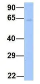 Anti-YTHDF3 antibody, N-term used in Western Blot (WB). GTX45261