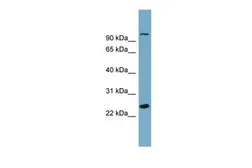 Anti-SEMA3D antibody, Internal used in Western Blot (WB). GTX45262