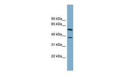 Anti-HEPACAM antibody, N-term used in Western Blot (WB). GTX45265