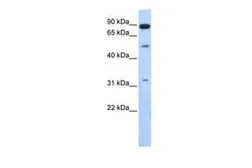 Anti-SENP5 antibody, Internal used in Western Blot (WB). GTX45267