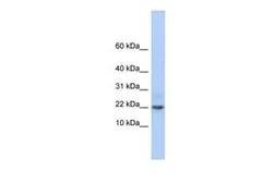 Anti-C9ORF25 antibody, Internal used in Western Blot (WB). GTX45271