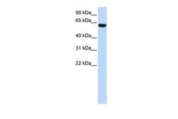 Anti-CCDC11 antibody, N-term used in Western Blot (WB). GTX45274