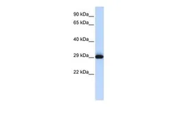 Anti-SUSD3 antibody, N-term used in Western Blot (WB). GTX45277